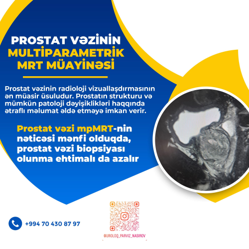 Prostat vəzinin multiparametrik MRT müayinəsi, Uroloq Pərviz Nasirov
